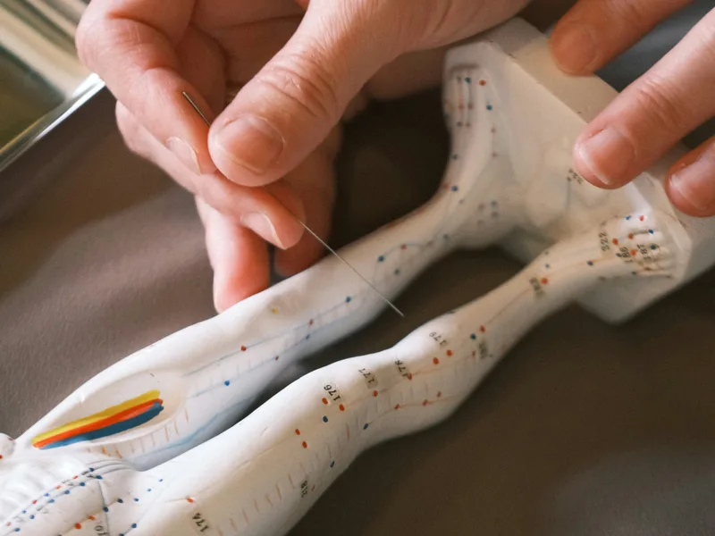 Acupuncture at Schomaker Chiropractic Clinic in Elk River