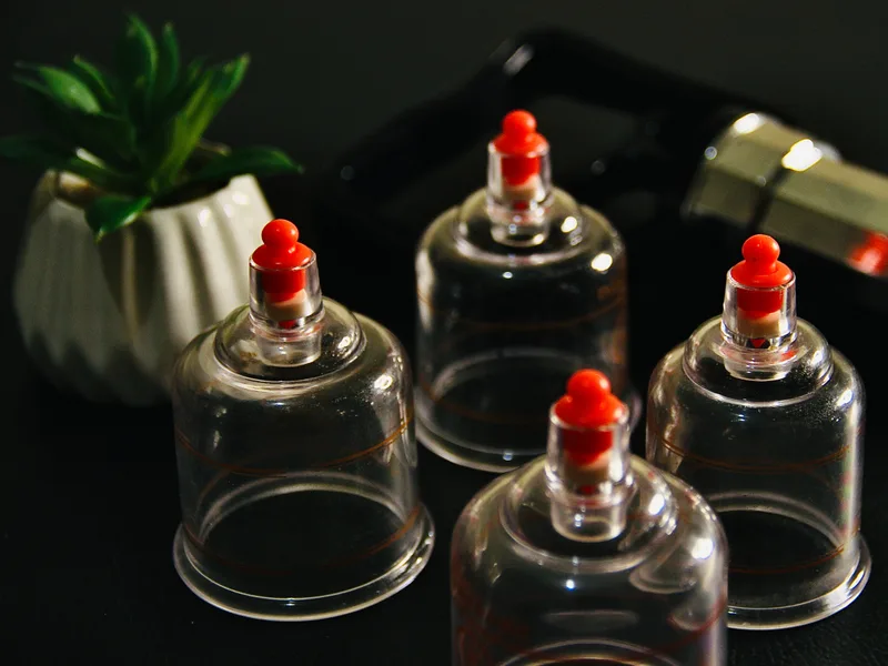 How Cupping Therapy works at Schomaker Chiropractic Clinic