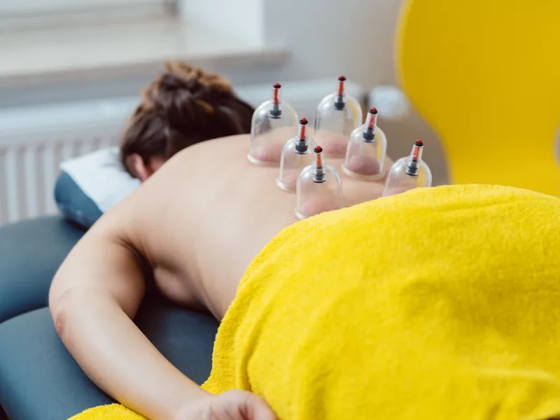 Cupping Therapy at Schomaker Chiropractic Clinic in Elk River