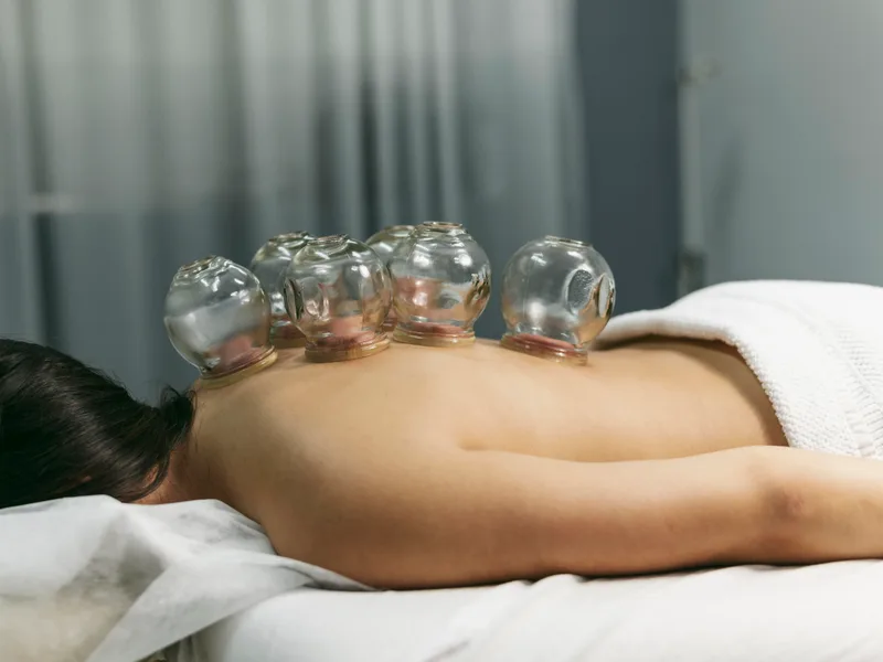 Cupping Therapy at Schomaker Chiropractic Clinic in Elk River