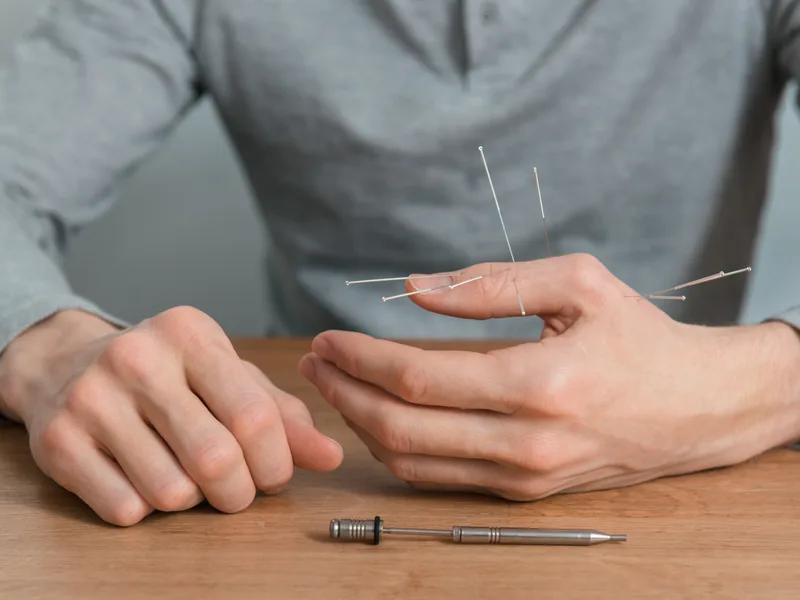 Dry Needling at Schomaker Chiropractic Clinic in Elk River
